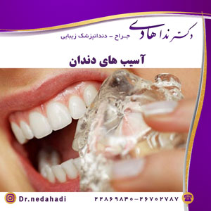 آسیب های دندان