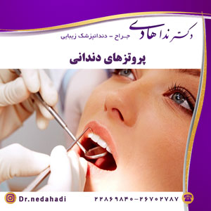 پروتزهای دندانی