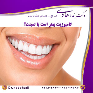 کامپوزیت بهتر است یا لمینت؟
