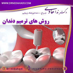 روش های ترمیم دندان