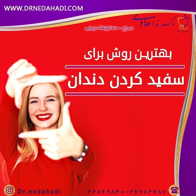 بهترین روش سفید کردن دندان