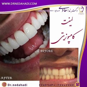 بهترین دندانپزشکی زیبایی