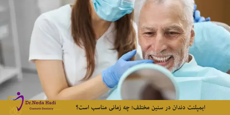 ایمپلنت دندان در سنین مختلف؛ چه زمانی مناسب است؟