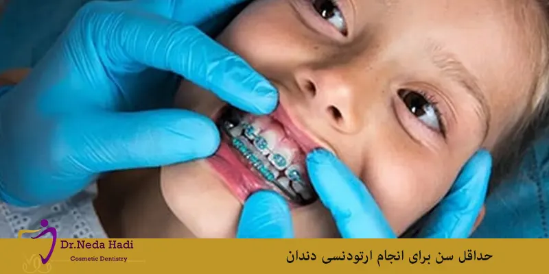 حداقل سن برای انجام ارتودنسی دندان