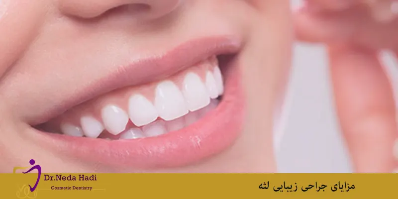 مزایای جراحی زیبایی لثه