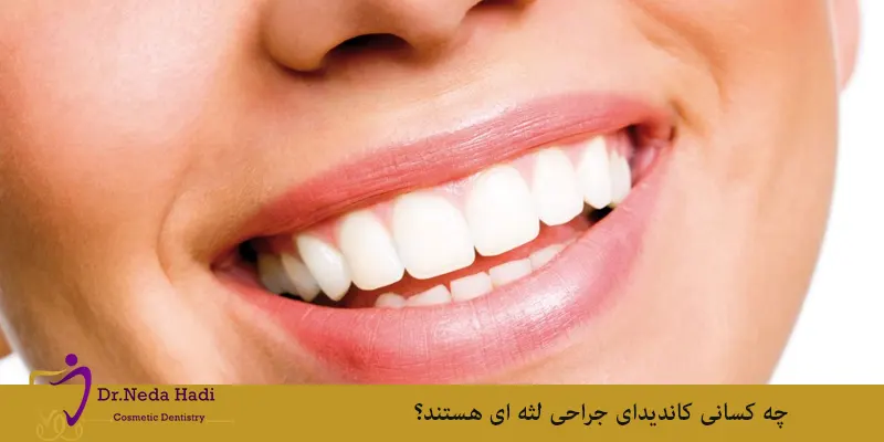 چه کسانی کاندیدای جراحی لثه ای هستند؟