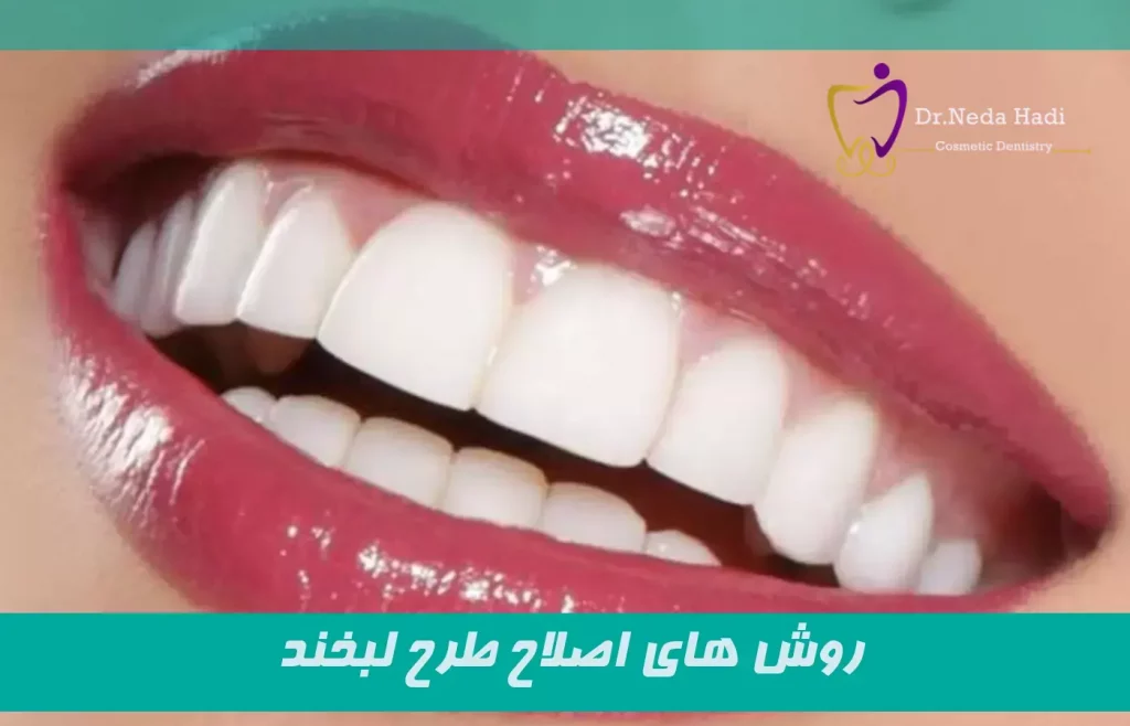 روش های اصلاح طرح لبخند