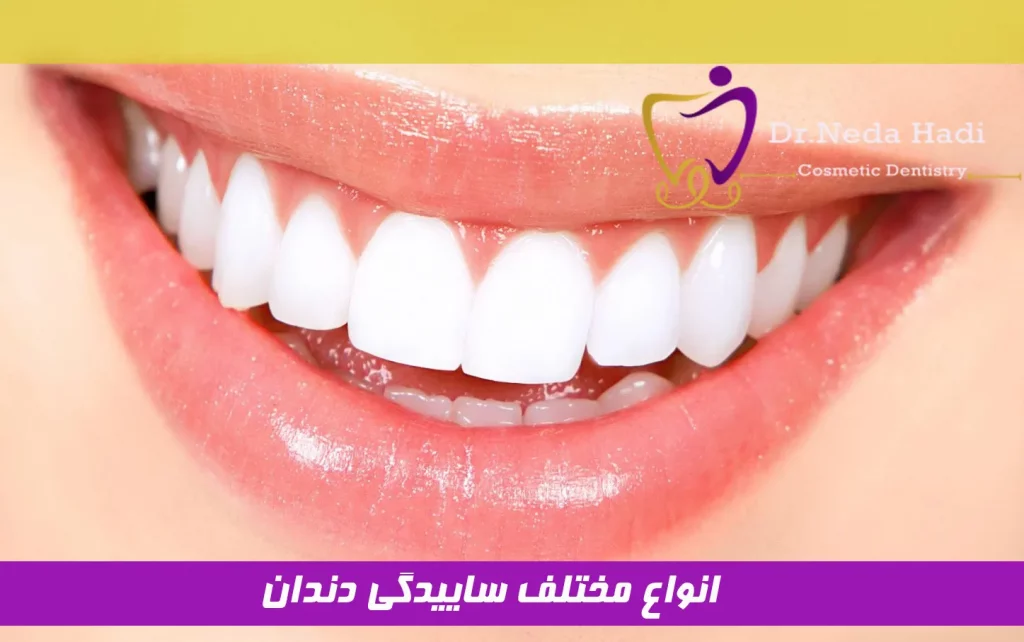 انواع مختلف ساییدگی دندان