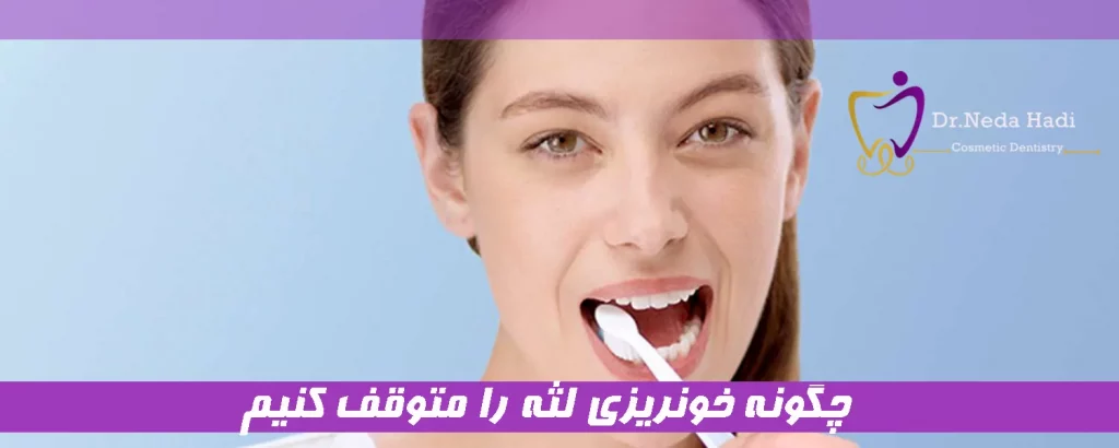  چگونه خونریزی لثه را متوقف کنیم