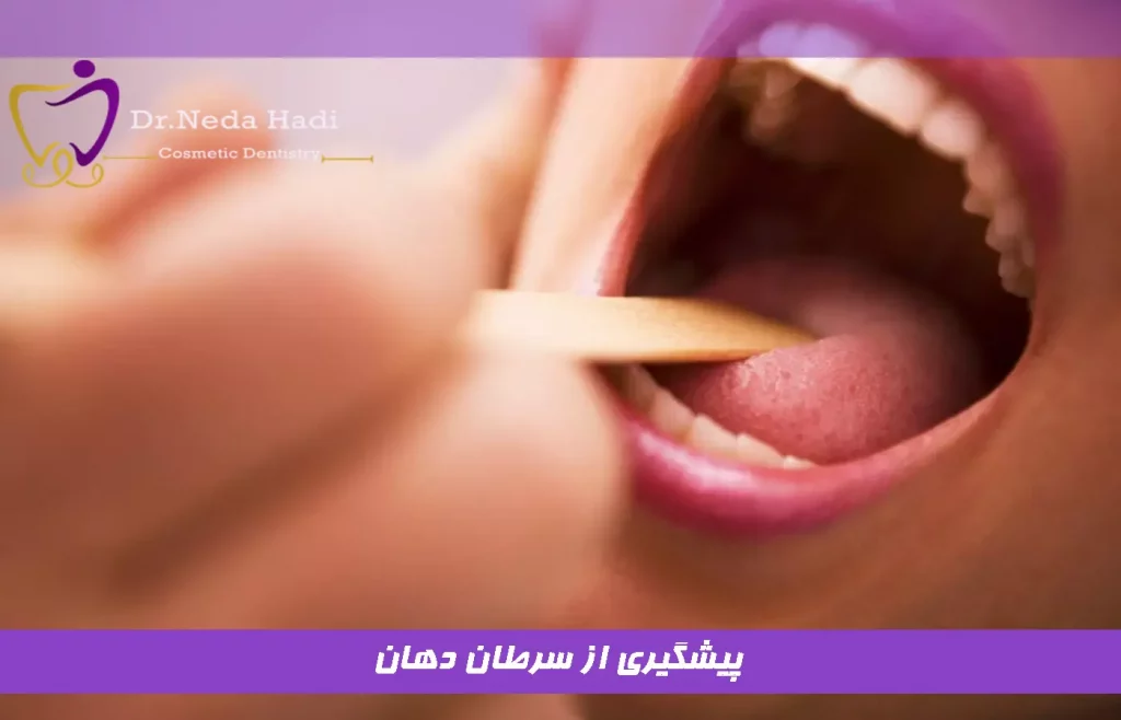پیشگیری از سرطان دهان 