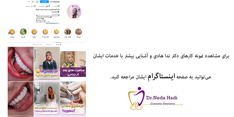ایسنتاگرام-دکتر-ندا-هادی
