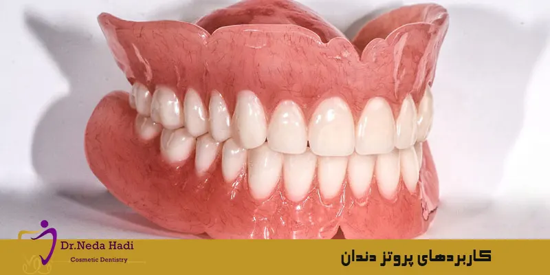 کاربردهای-پروتز-دندان