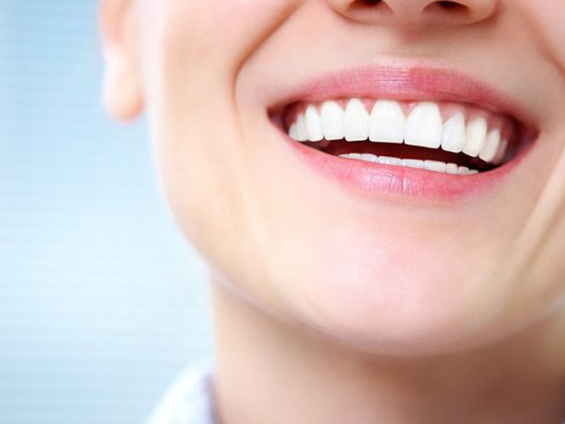 لمینت سرامیکی دندان + مزایا