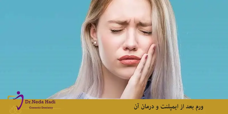 ورم-بعد-از-ایمپلنت-و-درمان-آن