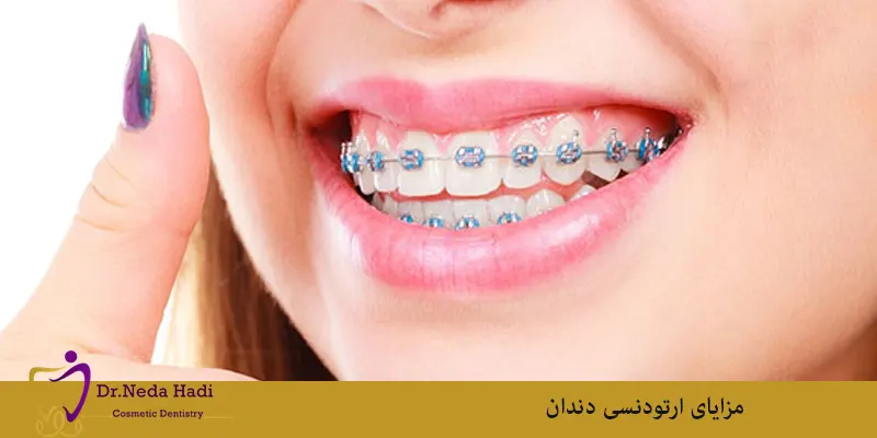 مزایای ارتودنسی دندان