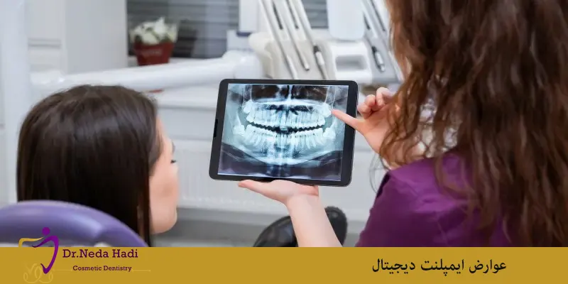 عوارض ایمپلنت دیجیتال