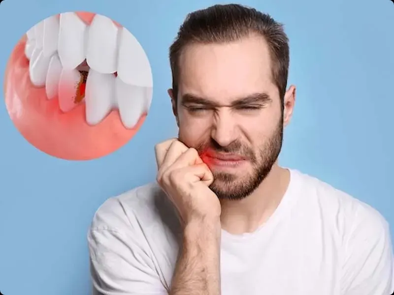 پس زدن ایمپلنت دندان + علائم هشداردهنده