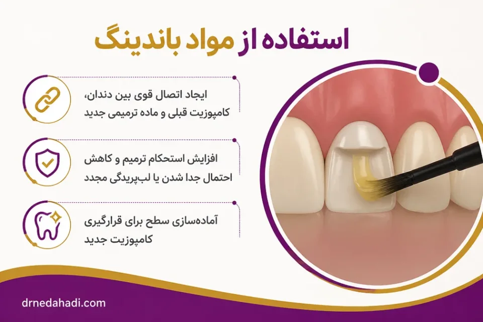 نمای توضیحی درباره استفاده از مواد باندینگ