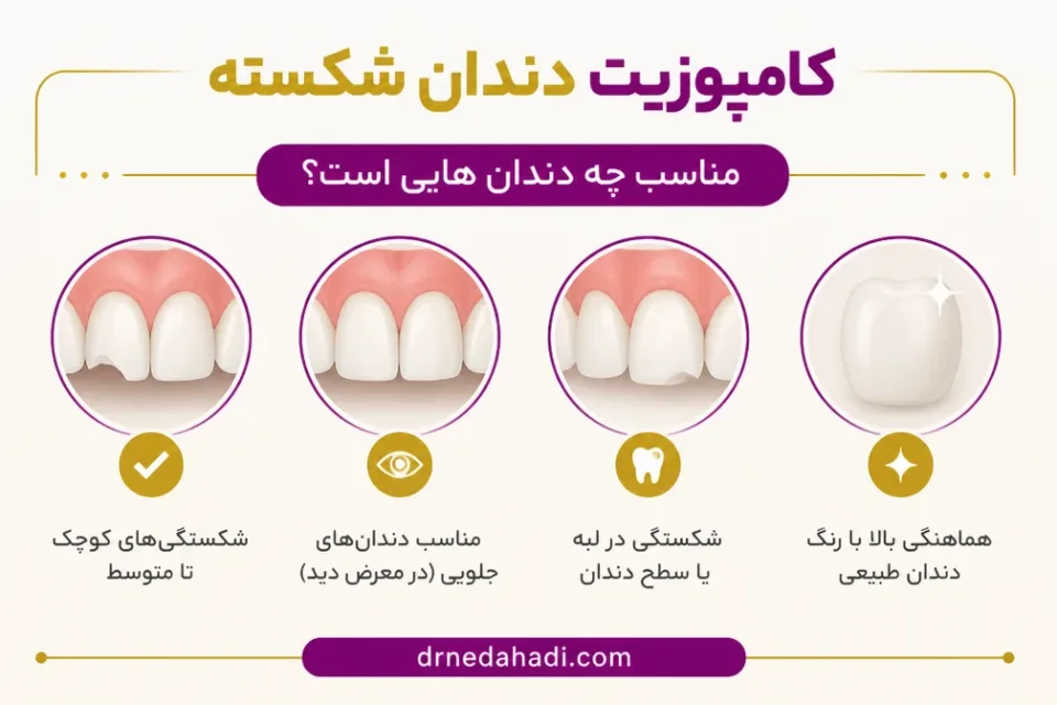 نمای توضیحی درباره کامپوزیت دندان شکسته مناسب چه دندان هایی است
