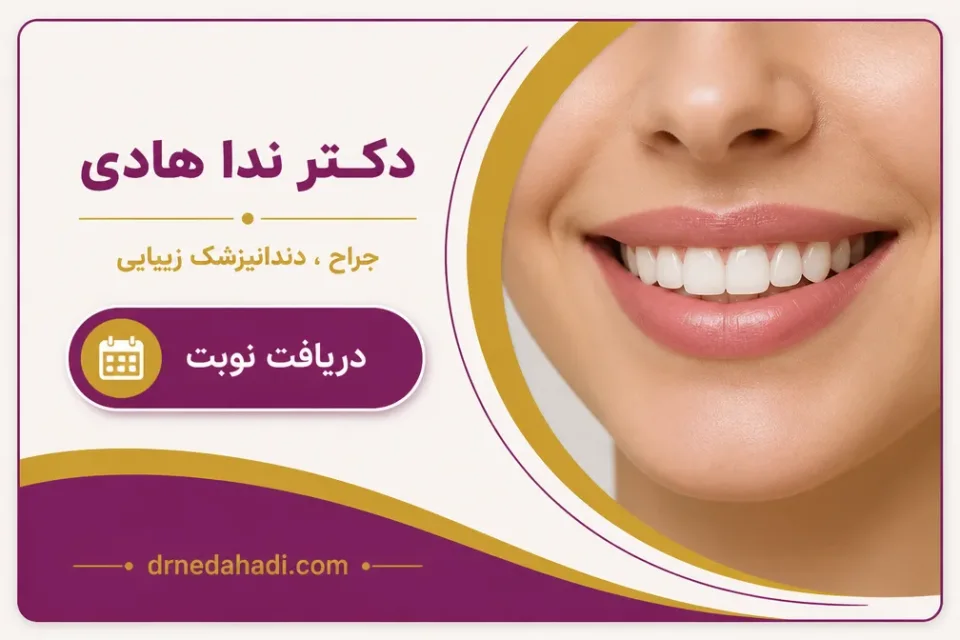 نمای توضیحی درباره ثابت کردن مواد کامپوزیت