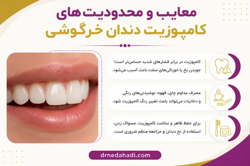 نمای توضیحی درباره معایب و محدودیت های کامپوزیت دندان خرگوشی